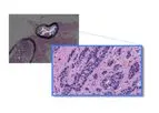 Paige - Novel Predictive and Prognostic Tissue-Based Biomarkers Software