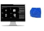 Adaptiiv - Modulated Electron Bolus Software