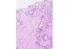 Halo Prostate - Version AI - AI-Powered Diagnostic Software