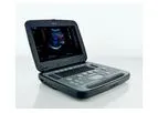 Siemens - Model Acuson P500 - Ultrasound System