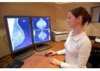 Breast Imaging Services