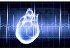 Cardiac Screening Services