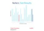 Echelon - Version PrenatalDx - Precise Data Software for Non-Invasive Prenatal Testing