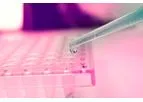 Cartherics - Autologous T cells