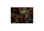 Apoptosis and Necrosis