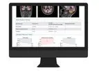 NeuroQuant - Version MSA - Multi-Structure Atrophy Report Software