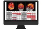 PETQuant - Fast & Automated Subregional Tracer Quantification Software