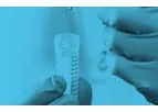 Sentrx BioHAnce - Ophthalmology and Epidermal Repair Technology