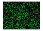 ScienCell - Model HAMEC 7200 - Human Adipose Microvascular Endothelial Cells