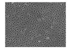 ScienCell - Model 1000 - Human Brain Microvascular Endothelial Cells