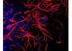 Aves - Anti-Glial Fibrillary Acidic Protein Antibody (GFAP)