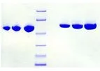 Athens - Model 16-16-012020 - Antithrombin III, Human Plasma