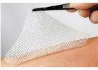 Lomatuell - Model H - Hydrophobic Paraffin Gauze Dressing