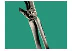 Inion FreedomPlate - Fracture Fixation System