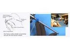 Cannuflow - Model TwoVu ST - Outflow Scope Sheath