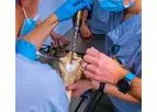 Arthroplasty
