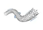 Stron - Model POLARIS ADVANCE - Peripheral Vascular Self-Expanding Stent System