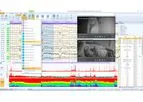 EEGStudio LTM Software