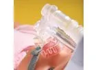 Inspire NCPAP - Non-Invasive Respiratory Support Device