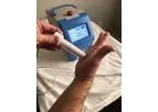 Plasmend - NTP Device