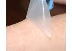 Scapa Soft-Pro - Model RX1423S - Low Trauma Silicone Gel Adhesive