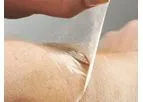 Scapa Soft-Pro - Polyurethane Gel Adhesive