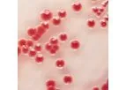 Chromagar - Acinetobacter