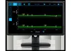 Remote Viewer and Connectivity