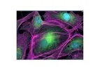 Protein Expression Services