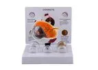Pro-Health - Model PH14-002 - Oversized Human Cataract Eye Anatomy Model for Patient Education