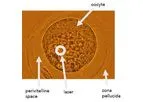 Brillouin IVF System