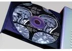CD Import / Data Reconciliation