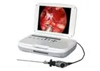 IKEDA - Model YKD-9003 - Full HD Medical Portable Endoscope Camera