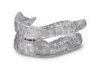 Glidewell - Model TAP 3 TL - Mandibular Advancement Devices