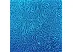 Human Chondrocytes: HC