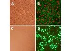 Human Aortic Endothelial Cells: HAOEC