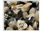 Dental Scrap Refining
