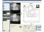 FilmQA - Pro 3.0 Software For Radiotherapy Plan Verification