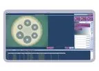 Synbiosis - Version eAST - Easy Antibiotic Susceptibility Testing Software