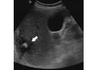 Non-Repro LA Ultrasonography Course