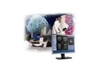 Discovery - Model MR901 - Magnetic Resonance Imaging System