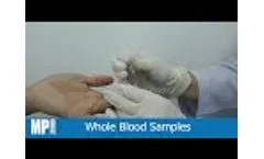 ASSURE SARS-CoV-2 Antibody rapid test kit - user instructional video - Video