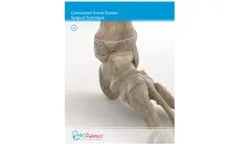 OrthoPediatrics - Model Gen II - Cannulated Screws - Brochure