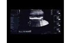 Auto Biometry - Video