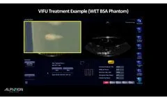 VIFU 2000 Wet type demonstration - Video