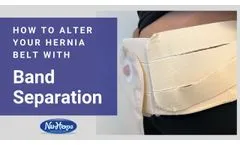 Nu-Hope Hernia Belt Alteration: Band Separation - Video