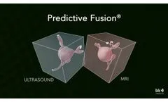 bkFusion: How it Works - Video