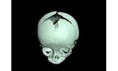Newborn Skull Phantom Desigin - Video