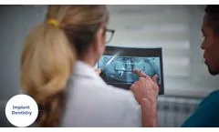 IRIS: Implant Real-time Imaging System - Video