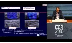 ECR 2016 Symposium - Clinical Innovations Improving Breast Cancer Diagnosis - Prof. Schäfer - Video